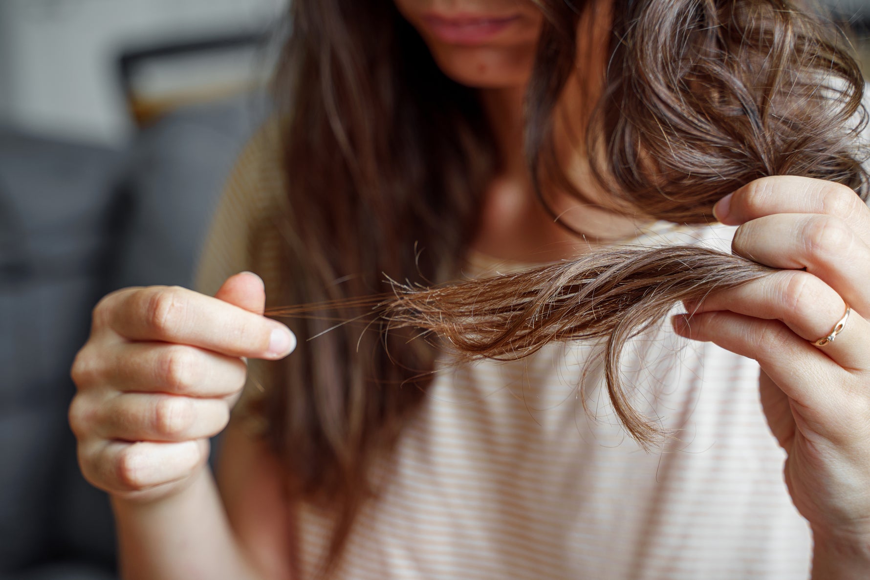 Stress can cause hair loos in a few ways.