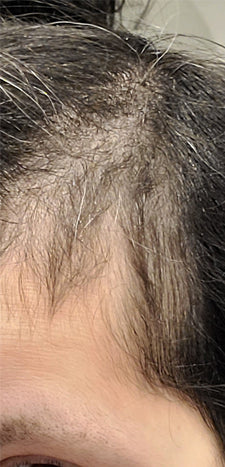 4 months before hairtamin
