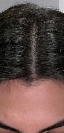 Customer after using HAIRtamin MOM - fuller hair