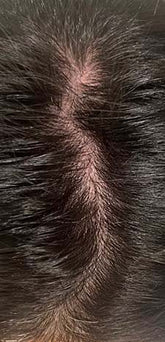 Real Hairtamin Results – HAIRtamin