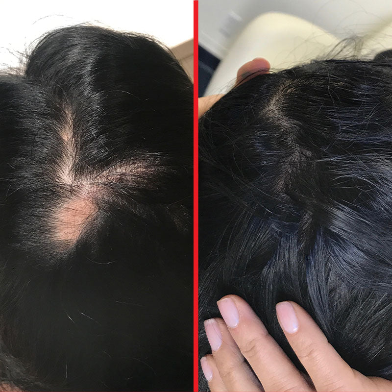 before and after photo of customer's scalp