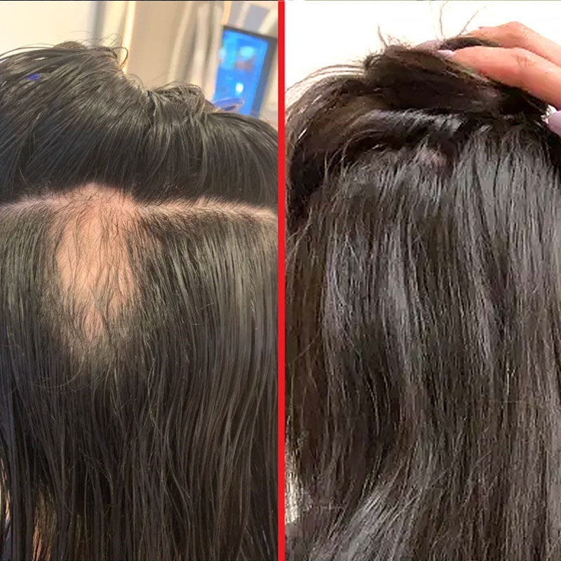 before and after using hairtamin