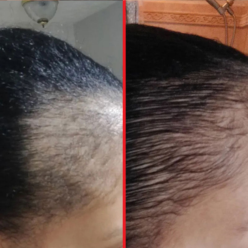 Before and after using scalp serum