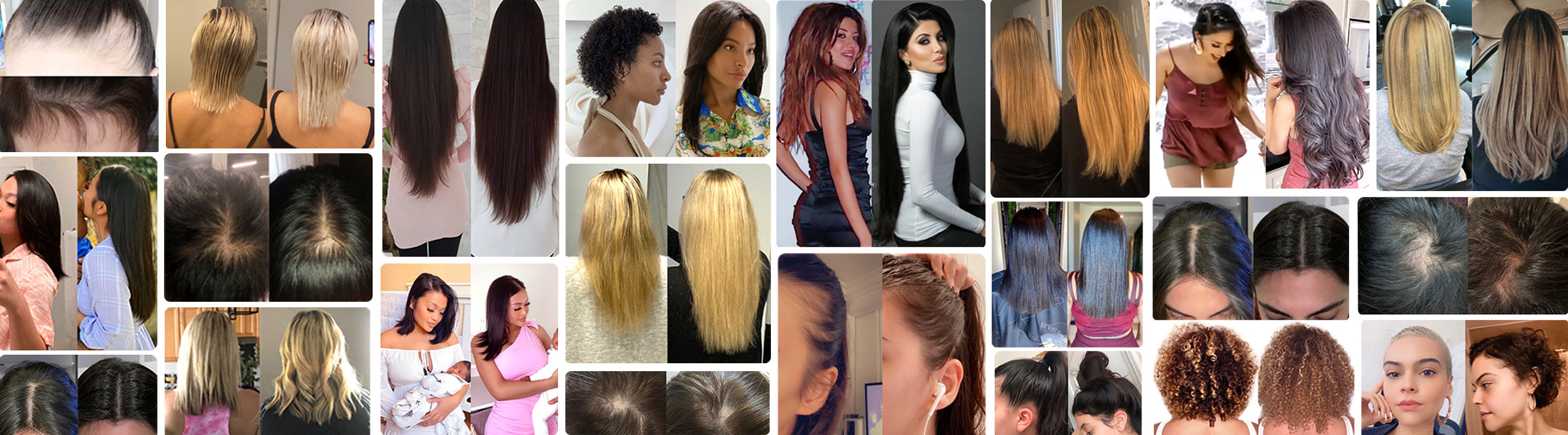 HAIRtamin customer results collage