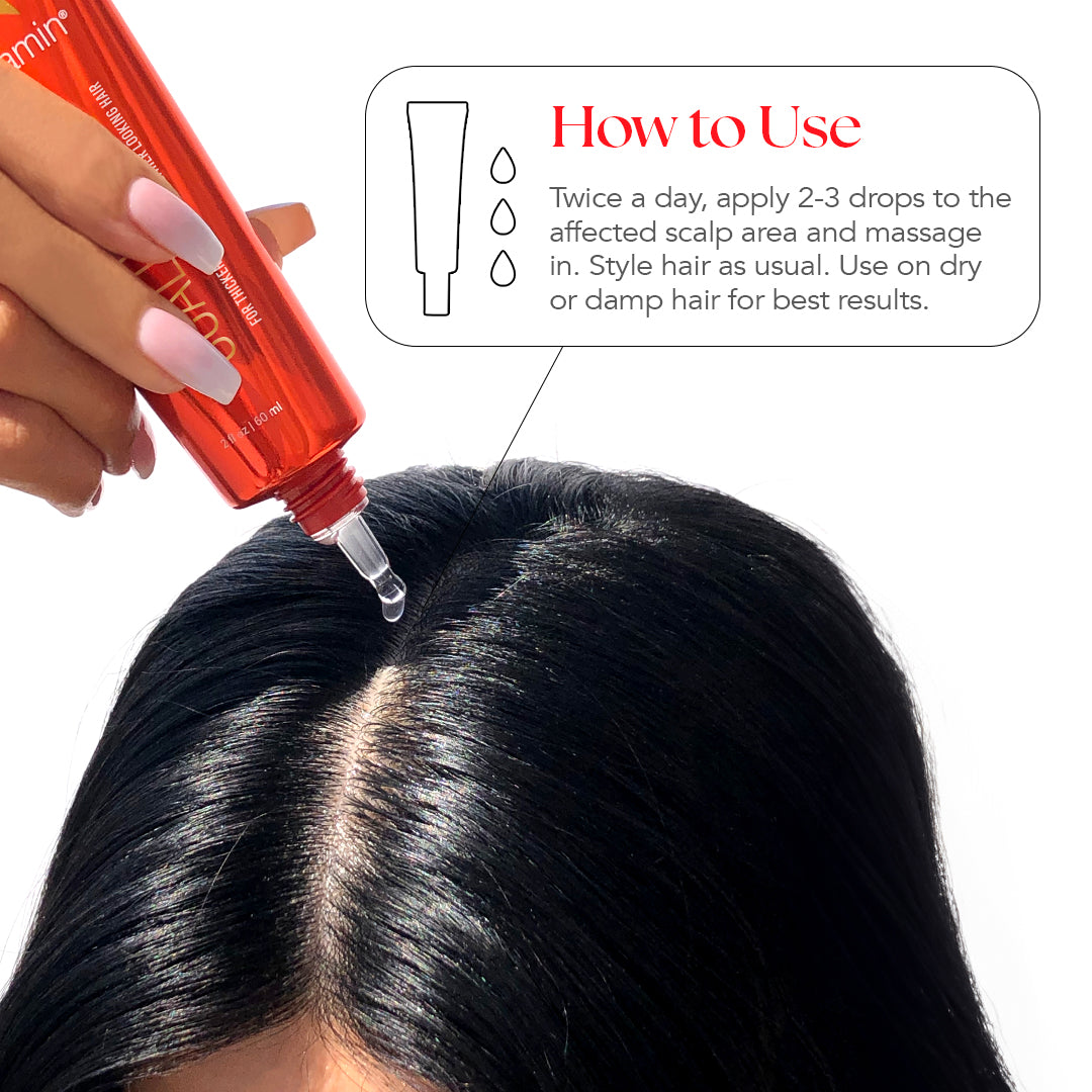 Twice a day, apply 2-3 drops to the affected scalp area and massage in