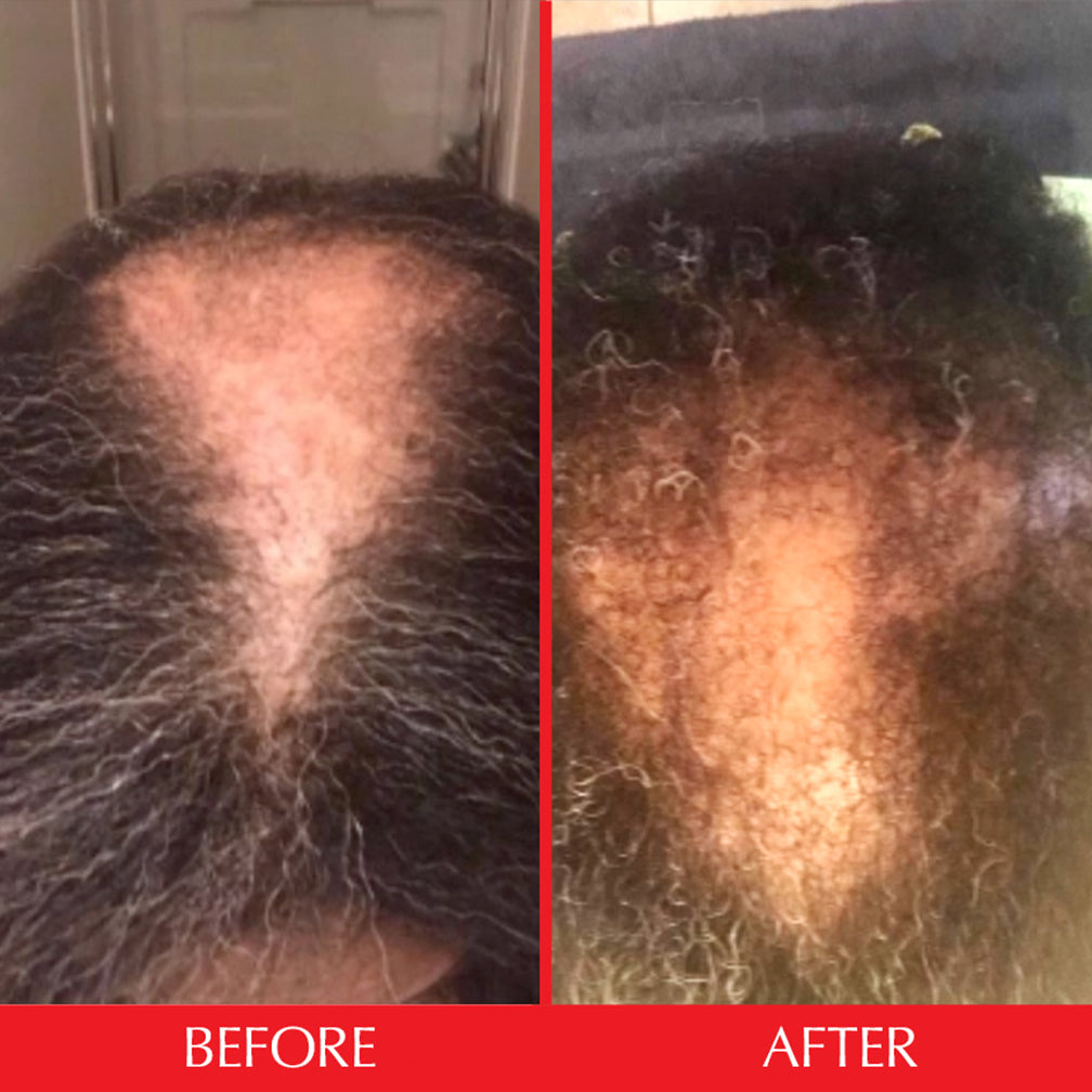 before and after scalp serum