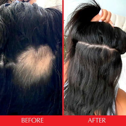 Before & after of a hairtamin customer two