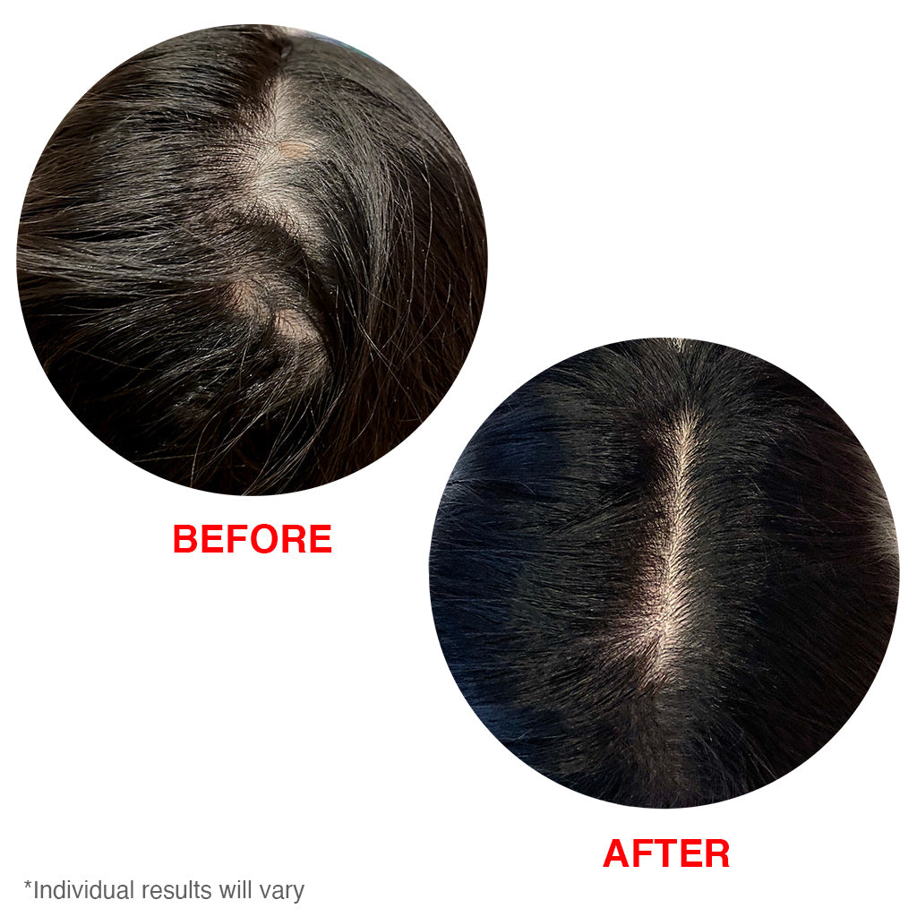 Before and after scalp serum photos